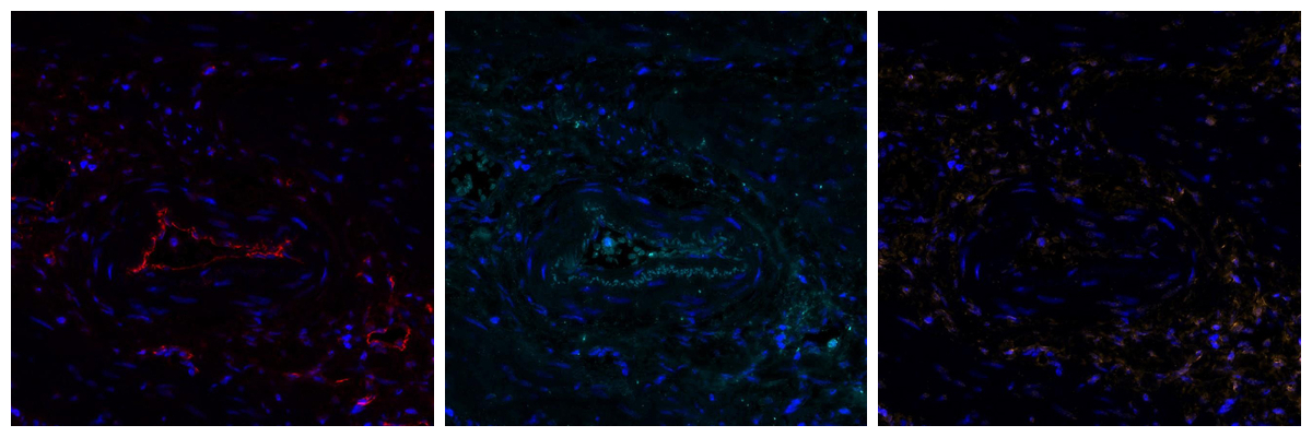 Máy quét huỳnh quang 180 slide