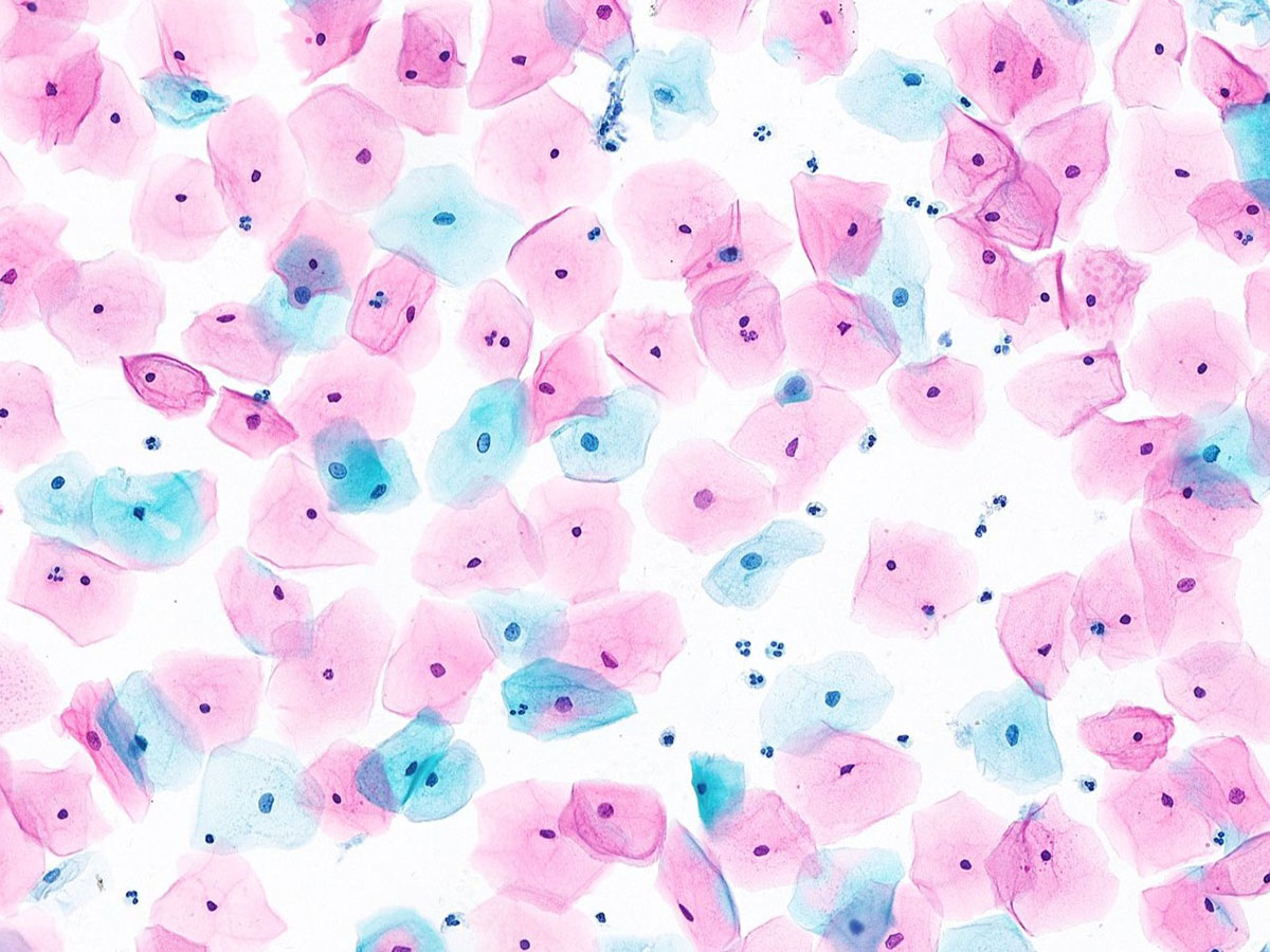 ماسح الخلايا السائل 180 شريحة.jpg