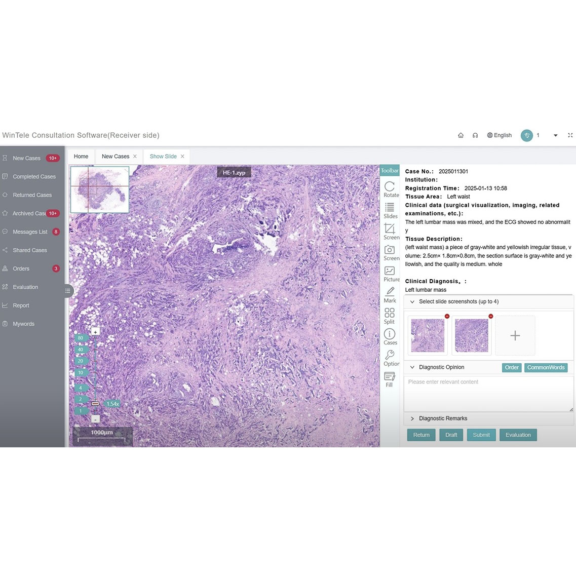 Phần mềm tư vấn từ xa