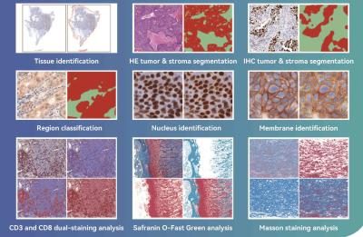 Digitale Pathologie-Bildanalyse