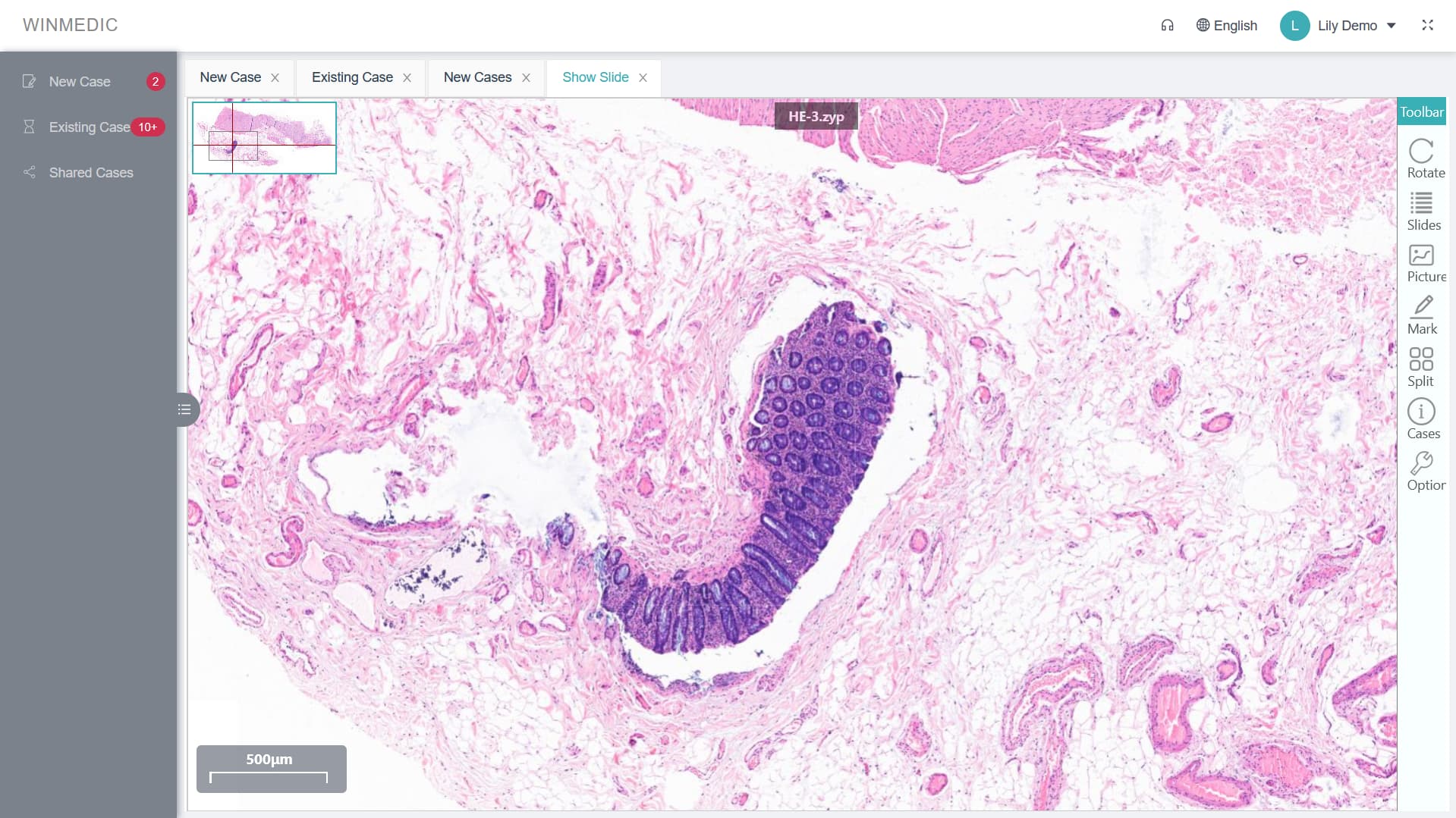 برنامج التشخيص عن بعد