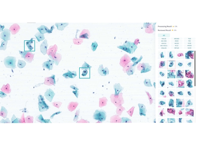 Système de traitement d’images cytologiques basé sur l’IA