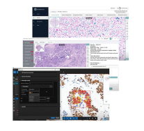 Point de vue WINMEDIC : Pathologie numérique IA
