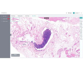 Giải pháp cộng tác bệnh lý từ xa