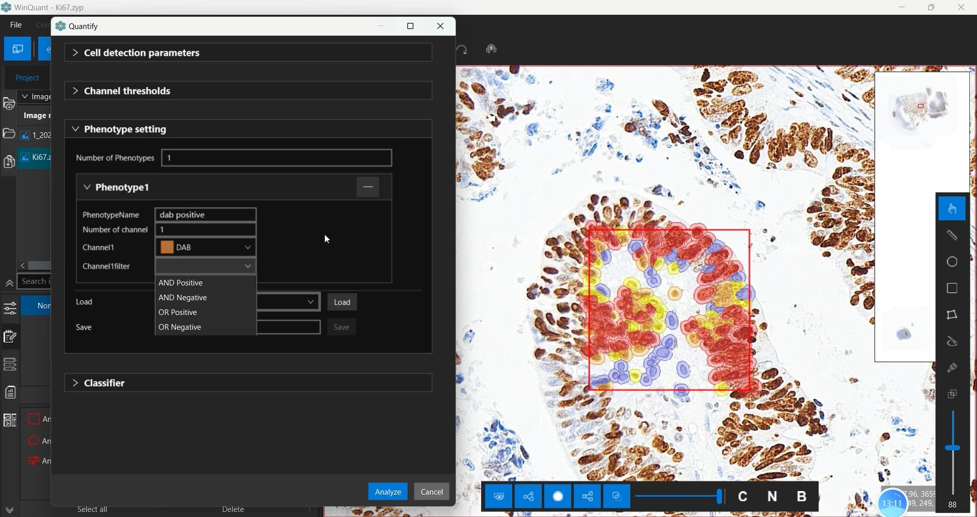 Phân tích định lượng bệnh lý