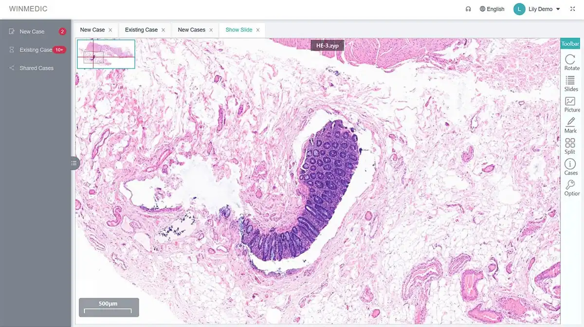 Solução de colaboração remota em patologia. jpg Solução de colaboração remota em patologia. jpg