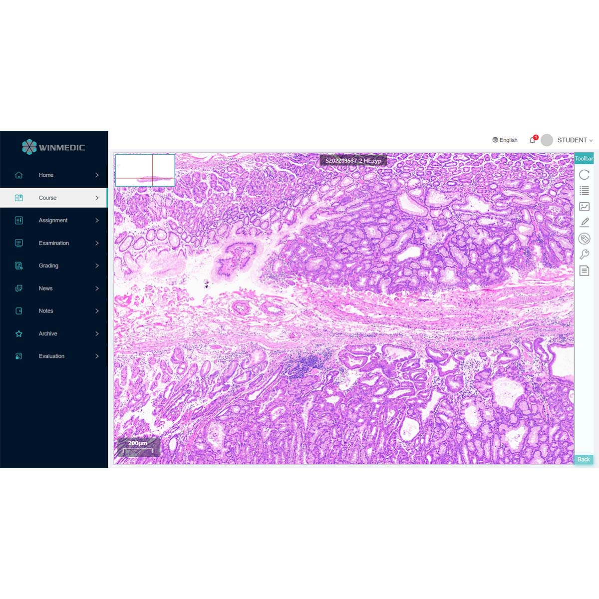 Pathologie-Ausbildungssoftware