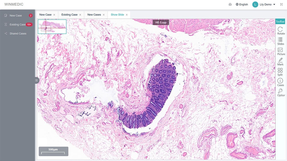 Giải pháp cộng tác bệnh lý từ xa.jpg