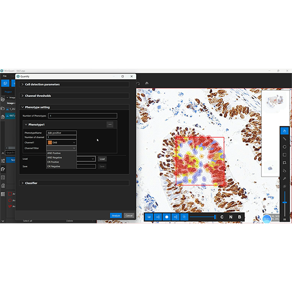 Quantitative Analysis Software