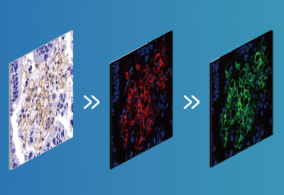 Phân tích định lượng bệnh lý