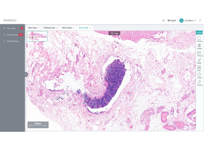 Teleconsultation Software