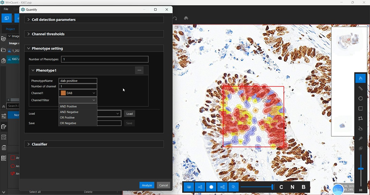 डिजिटल पैथोलॉजी इमेज विश्लेषण.jpg