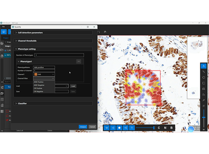 Quantitative Analysis Software