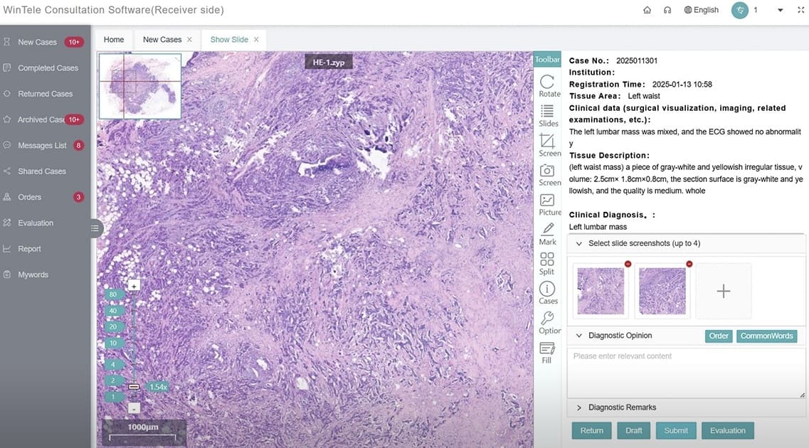 برنامج التشخيص عن بعد