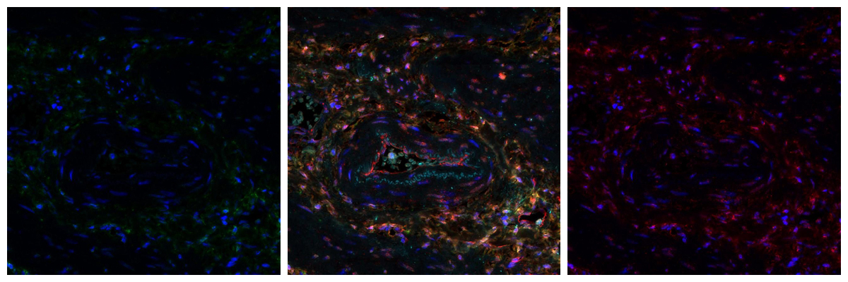 Máy quét huỳnh quang 180 slide